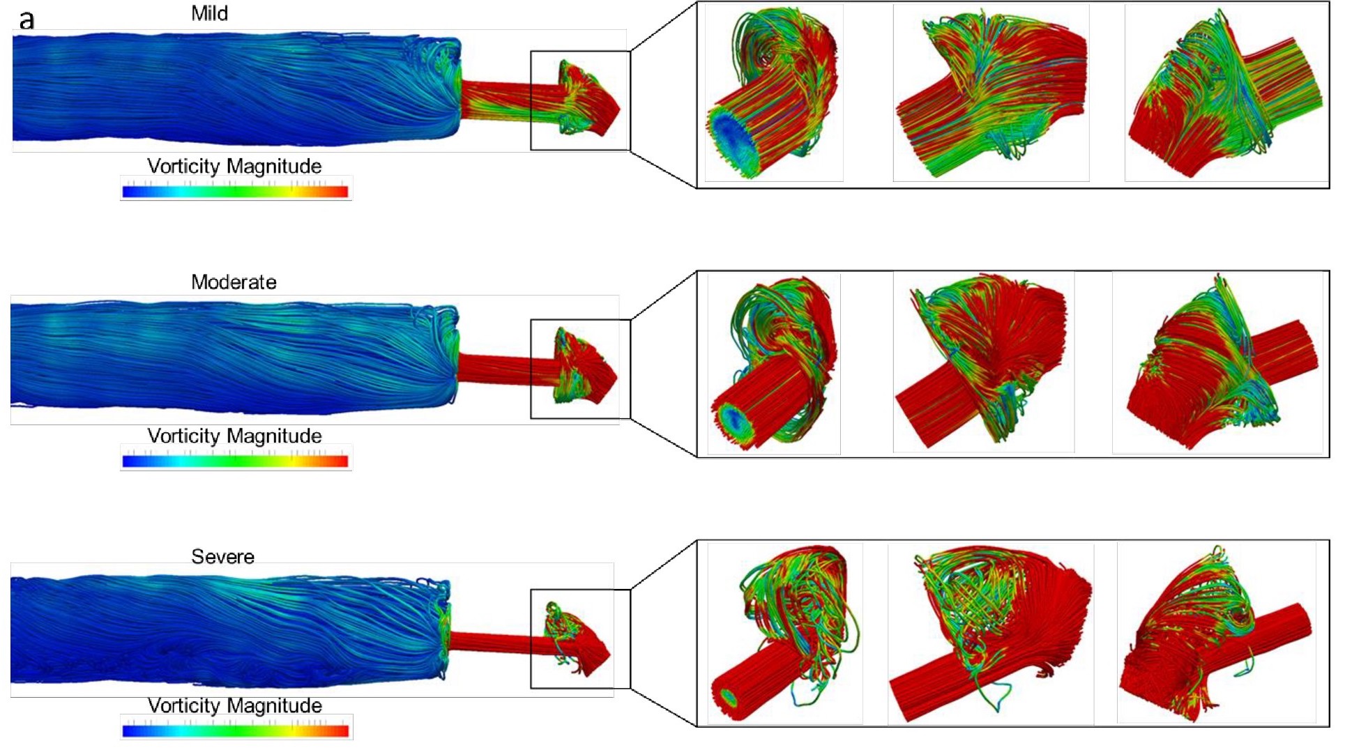 Urethral Stricture Disease | The Breyer Lab